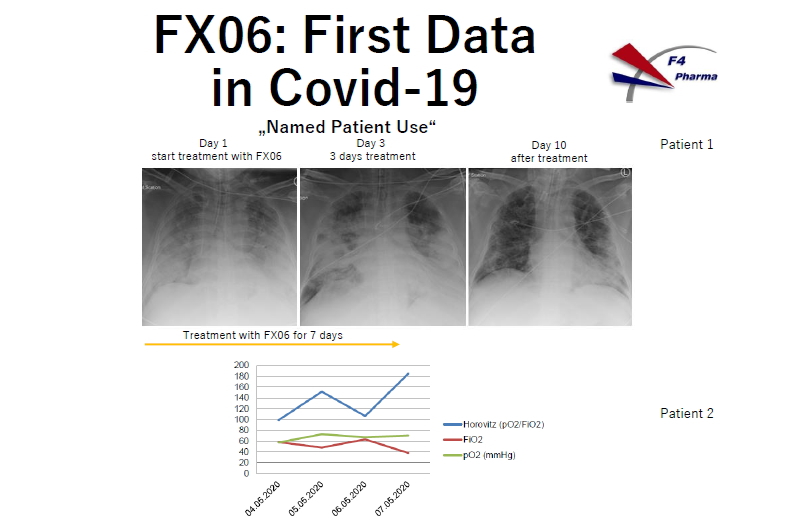 FX06:First Data in Covid-19 | 新型コロナウイルスの診断法と臨床経過：新型コロナウイルス感染症の基礎から臨床