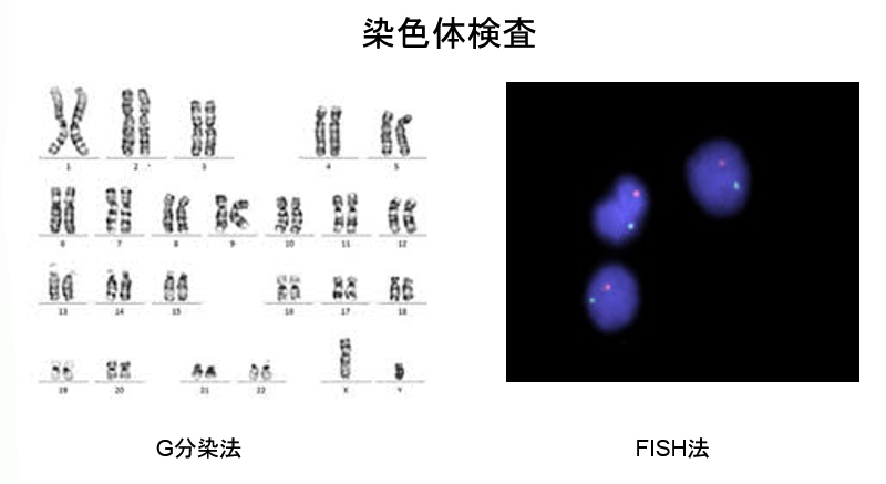 染色体検査・FISH検査